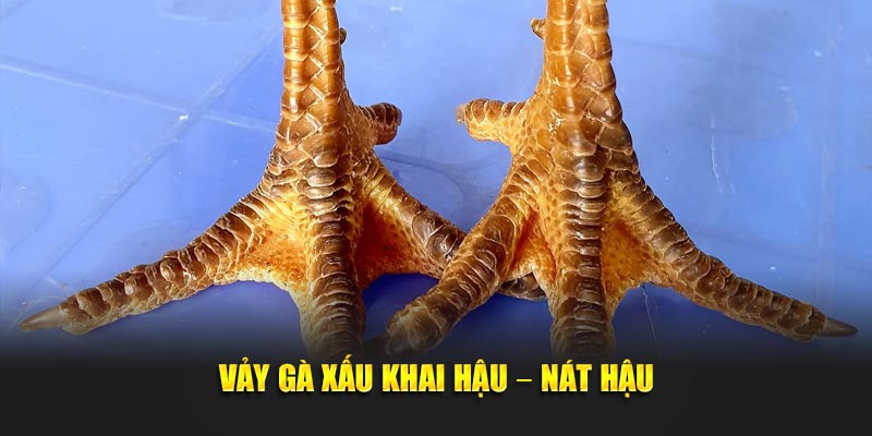 Tổng hợp các loại vảy gà xấu cần tránh